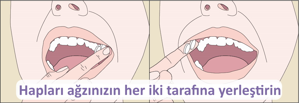 Ağızda Misoprostol